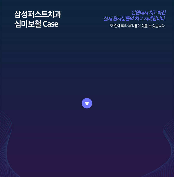심미치료