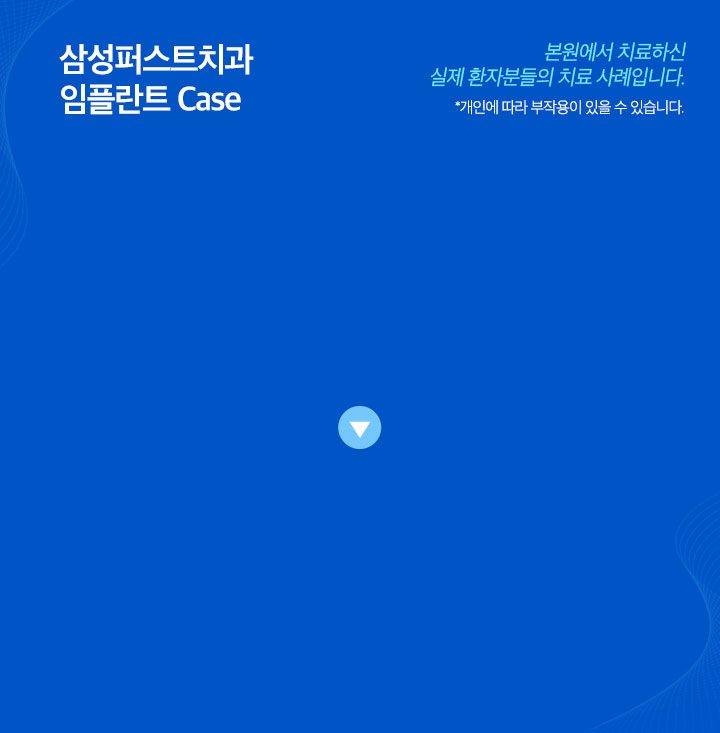 심미보철