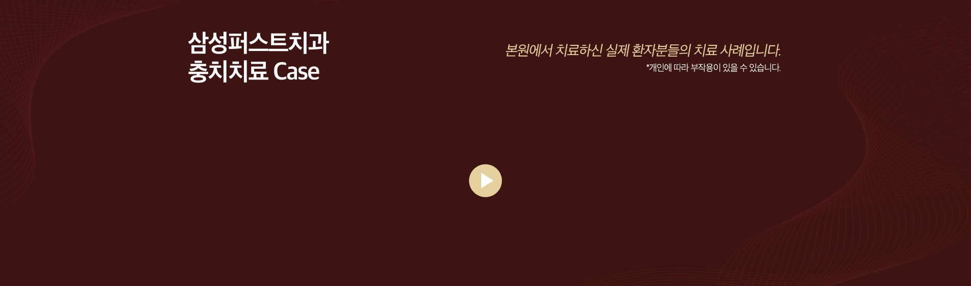충치치료