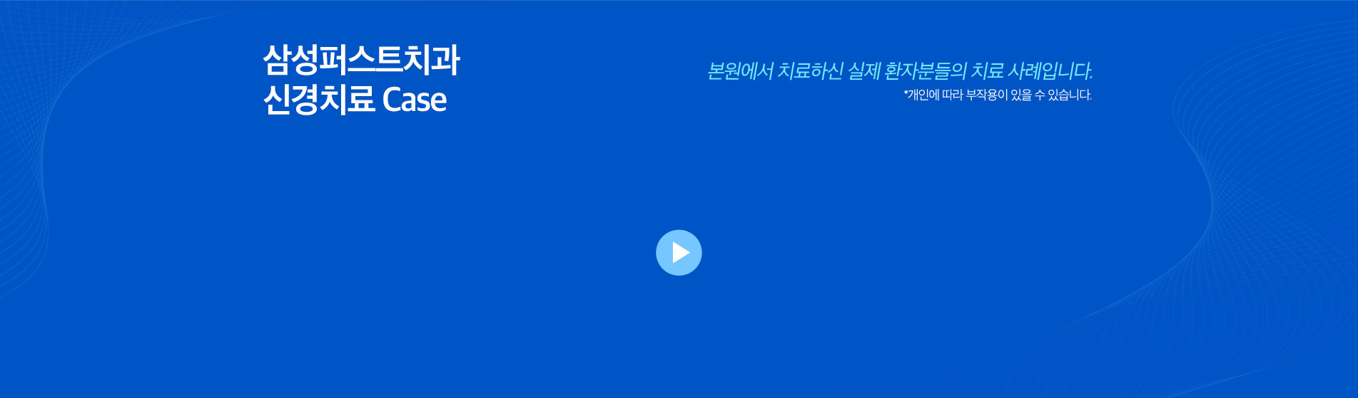 심미보철